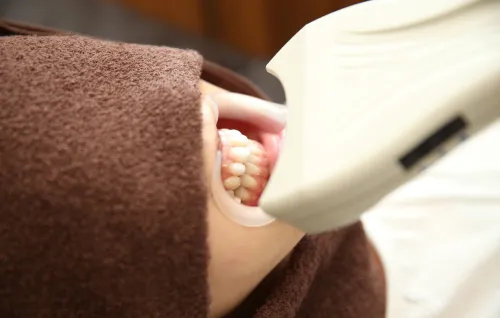 安心安全なホワイトニング