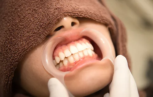 Image is not available