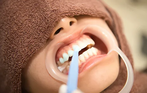 Image is not available