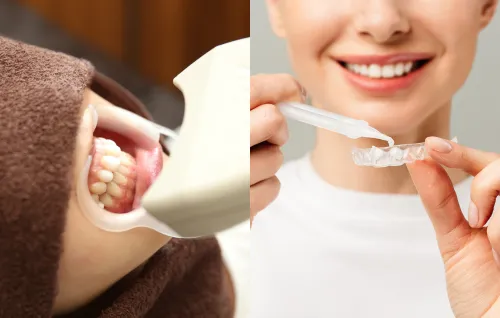 デュアルホワイトニング福岡天神