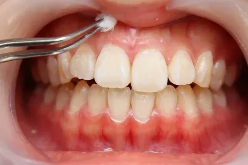 gum2.jpg